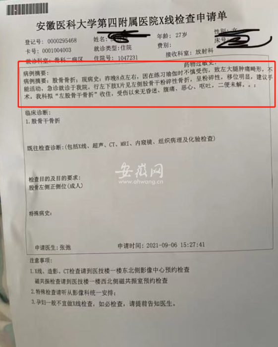 在被紧急送往医院后,经医院诊断为:王女士左侧股骨干粉碎性骨折,呈