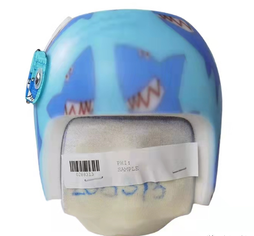 戴2.8万元头盔能让婴儿头型变好看?医生紧急提醒